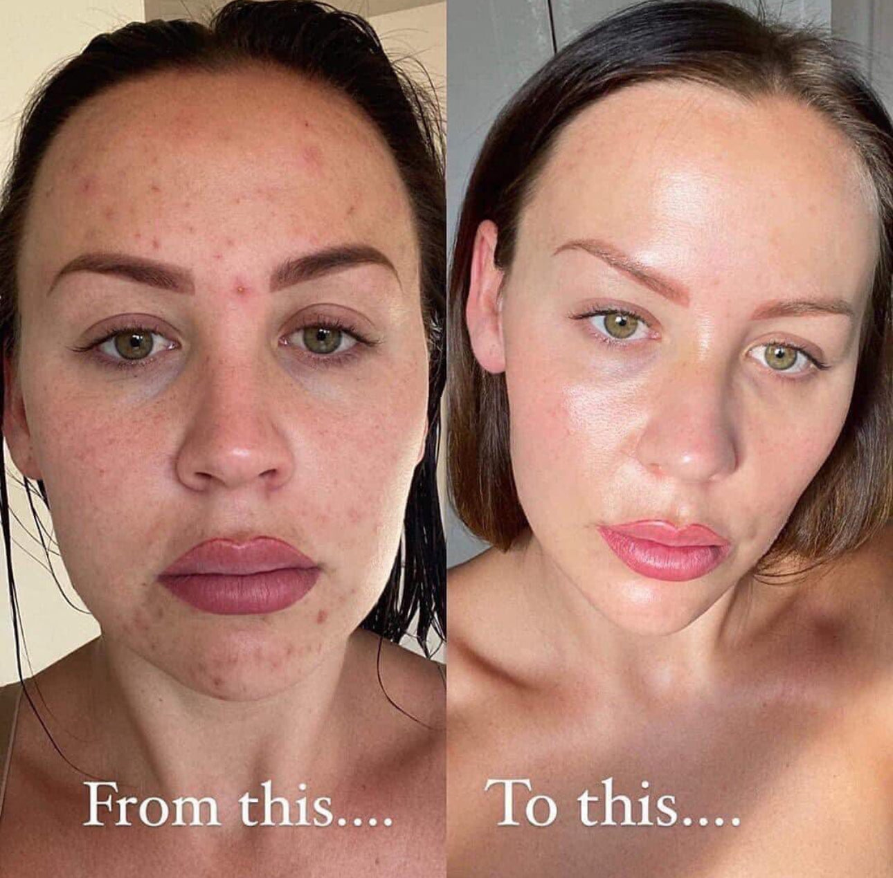 FACIAL MASSAGER LED LIGHT THERAPY