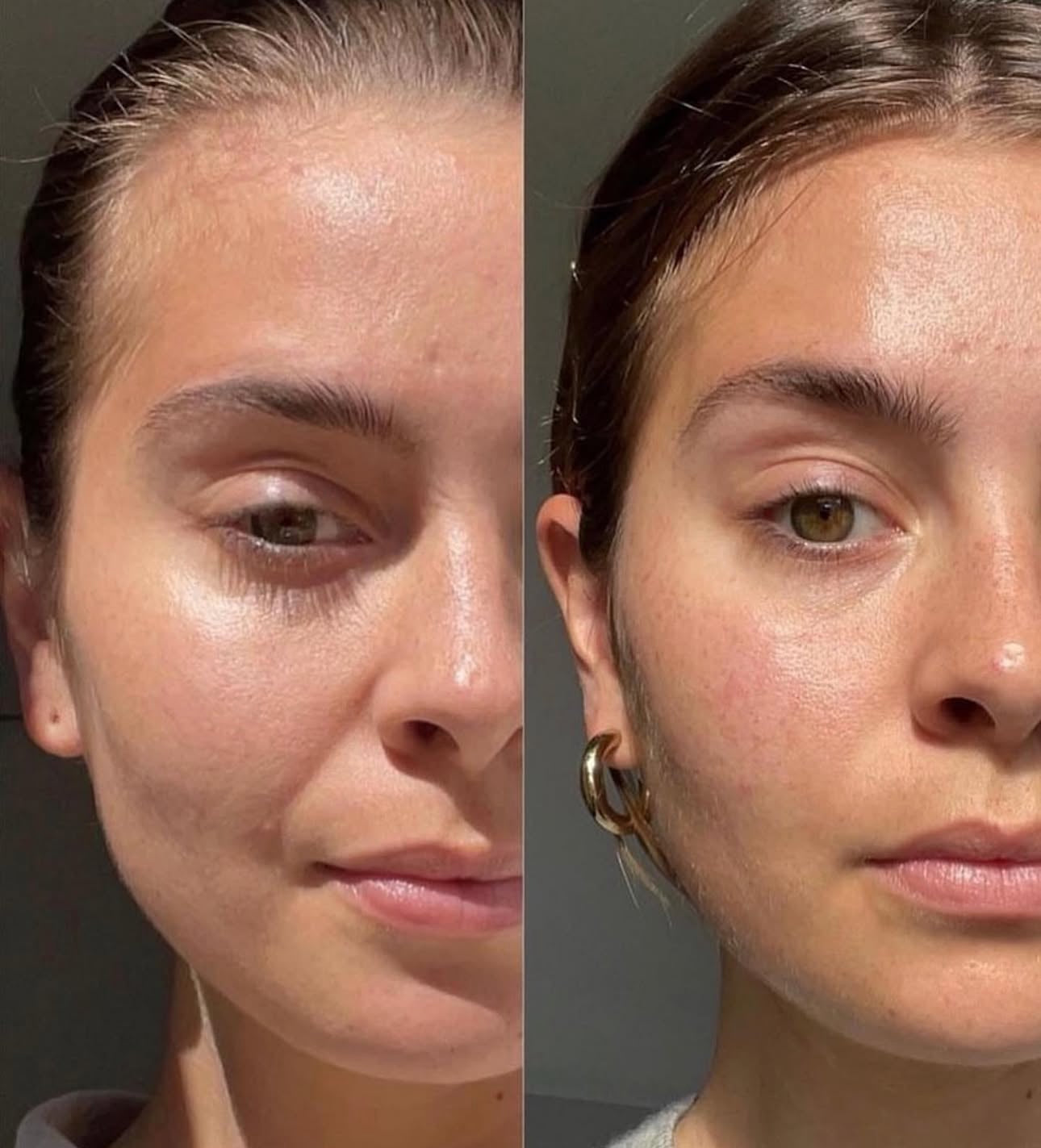 FACIAL MASSAGER LED LIGHT THERAPY